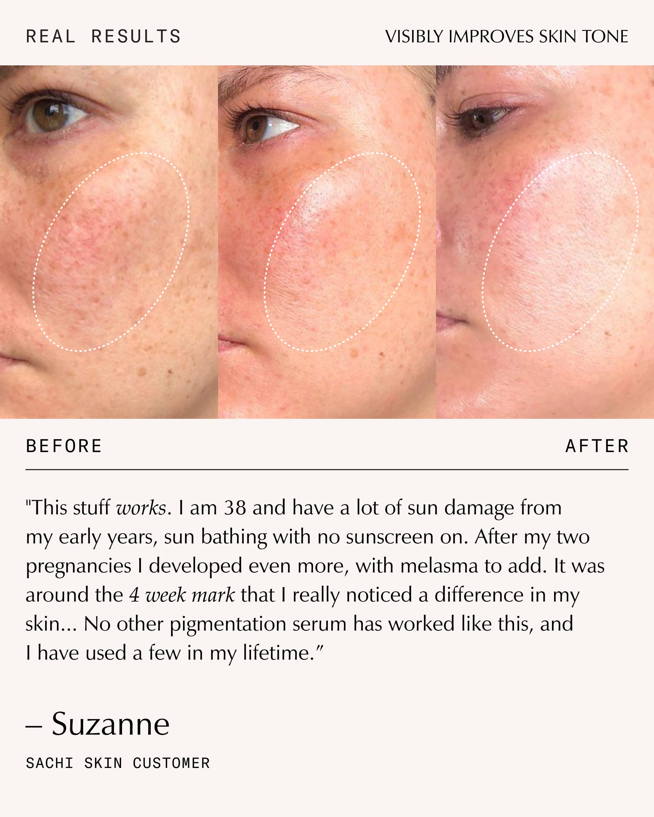 Triphala Pigmentation Corrector - 30ml