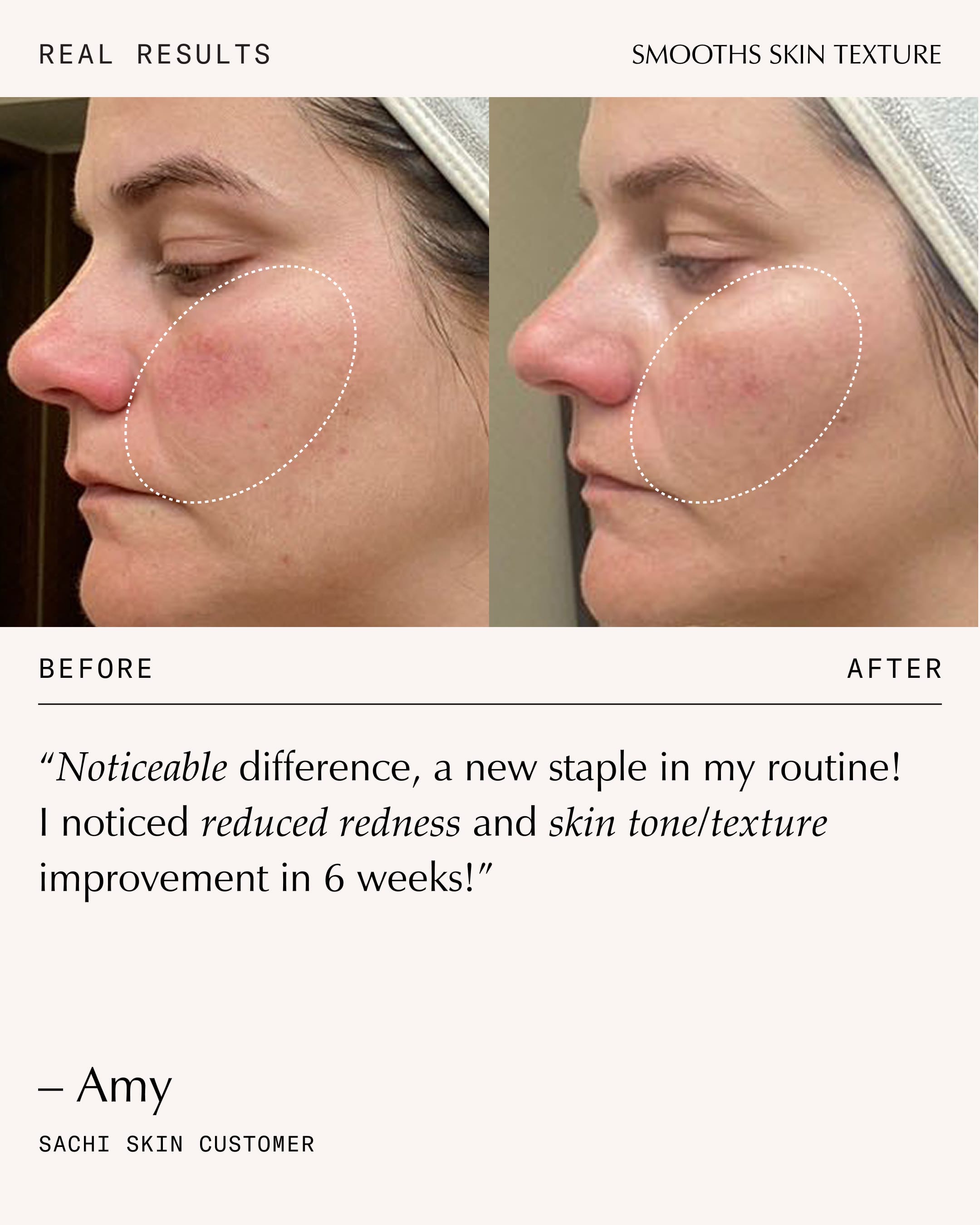 Peptide Pro Resilience® Serum Concentrate - 30ml