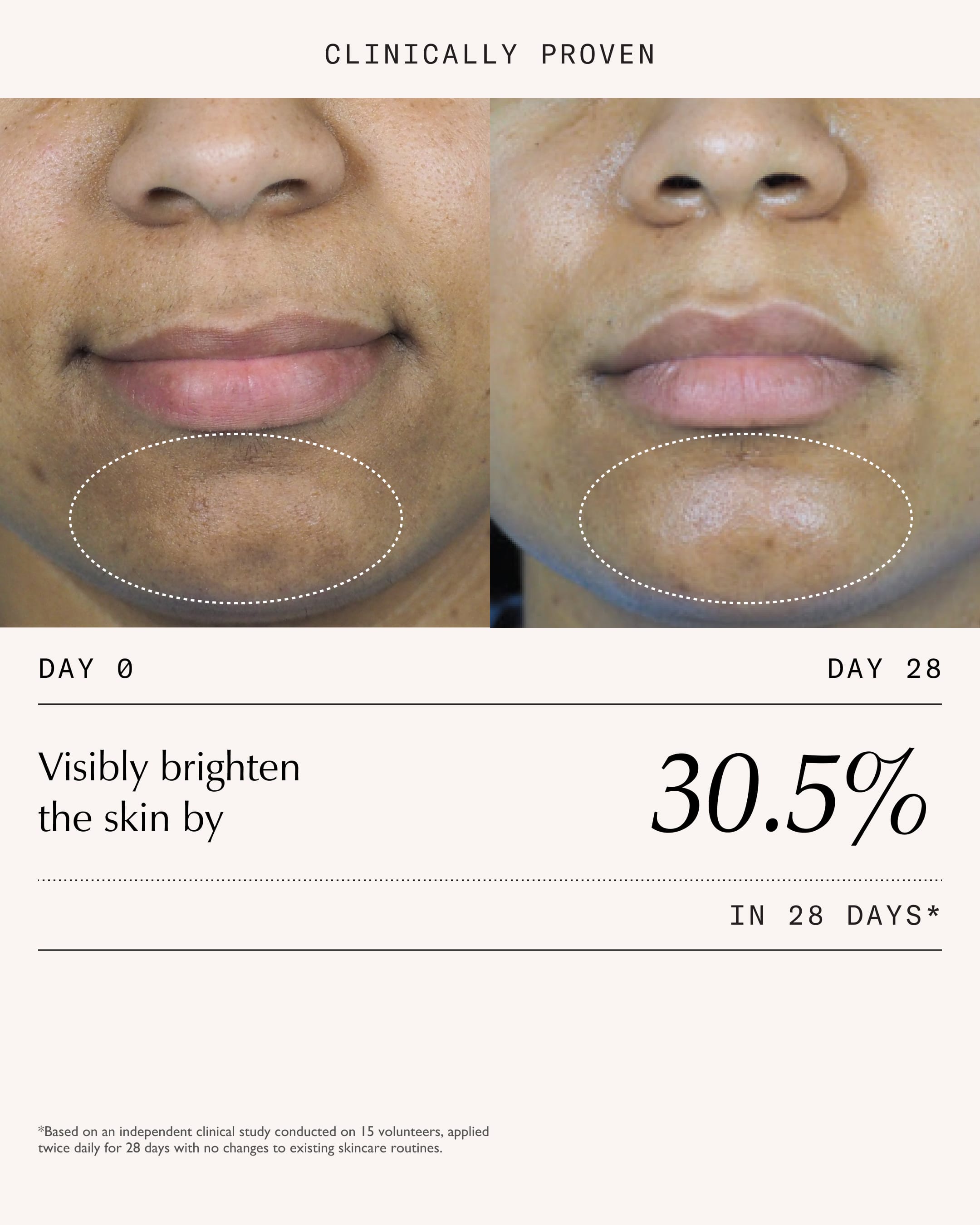 Triphala Pigmentation Corrector - 30ml