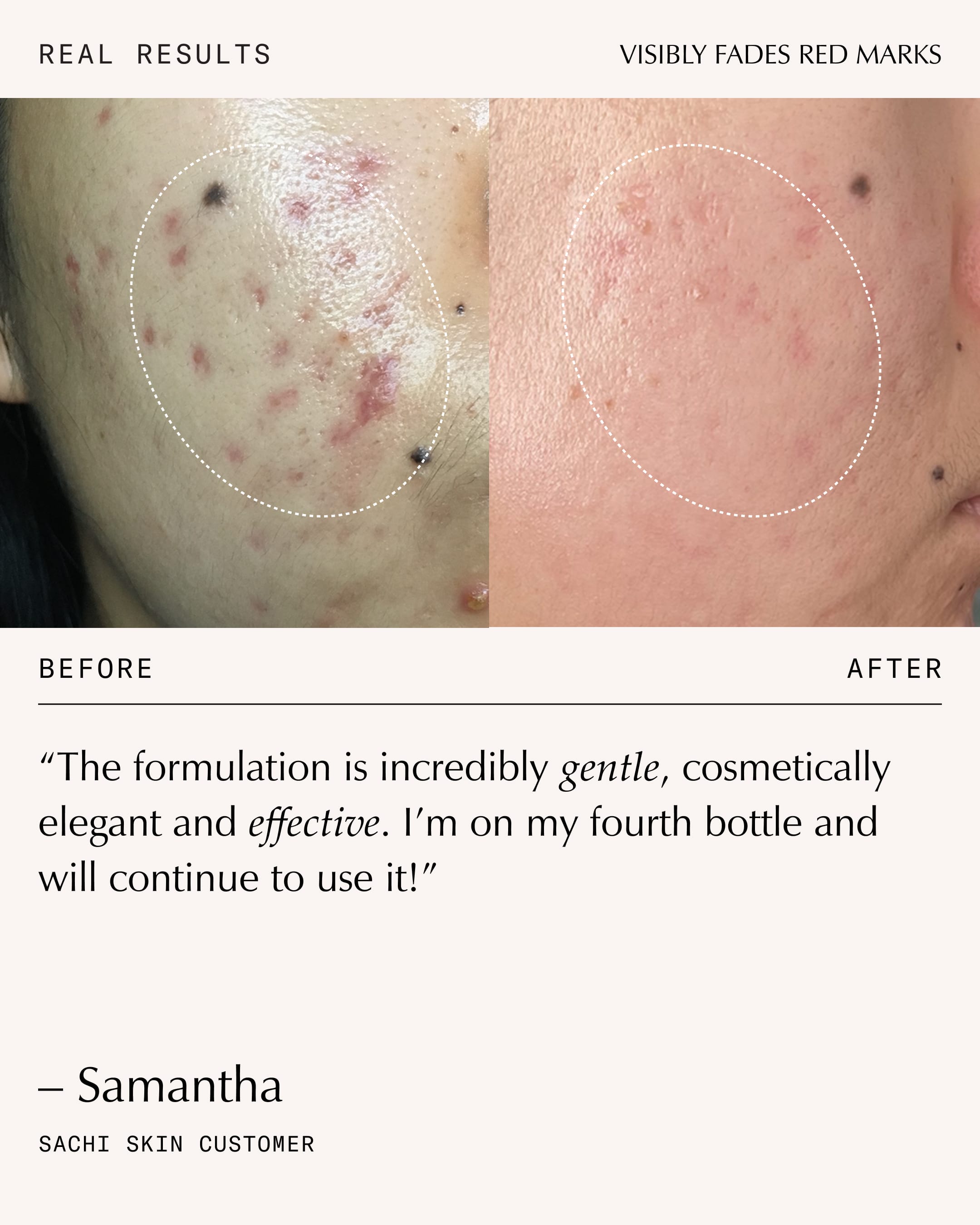 Triphala Pigmentation Corrector - 30ml